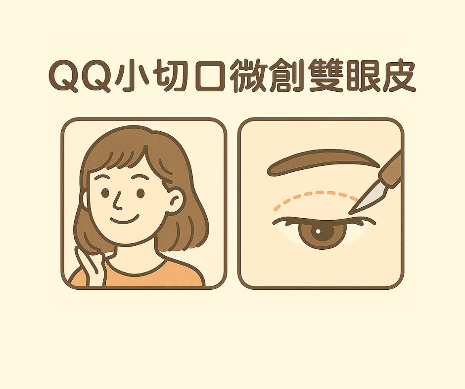 QQ小切口微創雙眼皮