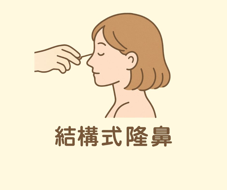 結構式隆鼻(縮鼻翼)